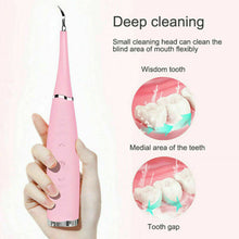 Load image into Gallery viewer, Ultrasonic Tooth Cleaning Wand
